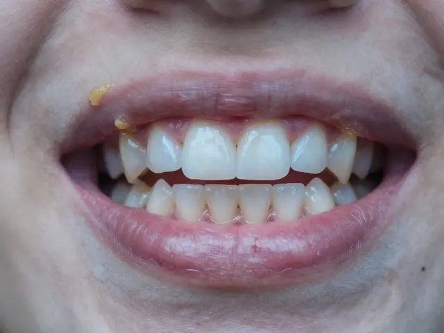 Co se stane, když se nebudeme čistit zuby? Důsledky zanedbávání ústní hygieny