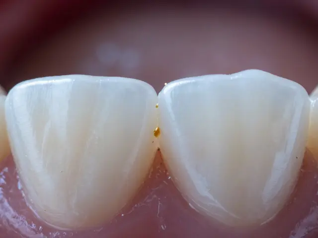 Jaké potraviny mohou způsobit mezizubní kaz? Komplettní průvodce rizikovými potravinami