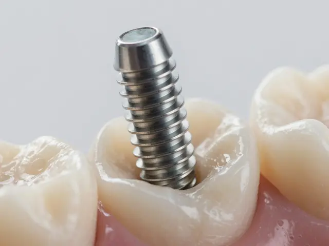 Jak zubní implantáty změnily stomatologii: Revoluce v náhradě chybějících zubů