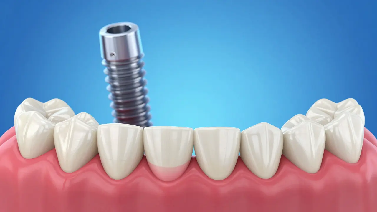 Ilustrace rozdílu mezi můstkem a implantátem u sousedních zubů