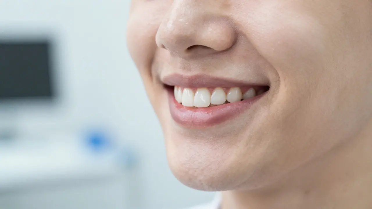 Jak probíhá augmentace zubů? Kompletní průvodce polepováním