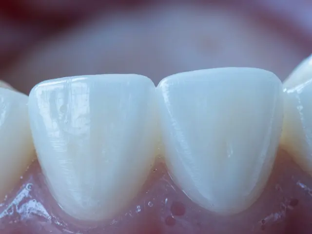Co nejíst a nepít po dentální hygieně? Kompletní průvodce péčí o zuby